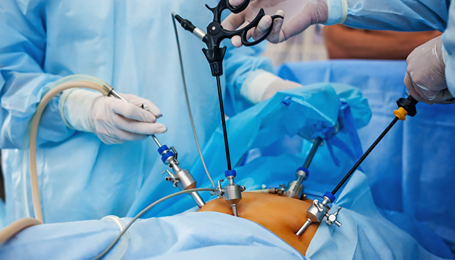 Laparoscopy Surgery in Ahmedabad | Minimally Invasive Gynecology